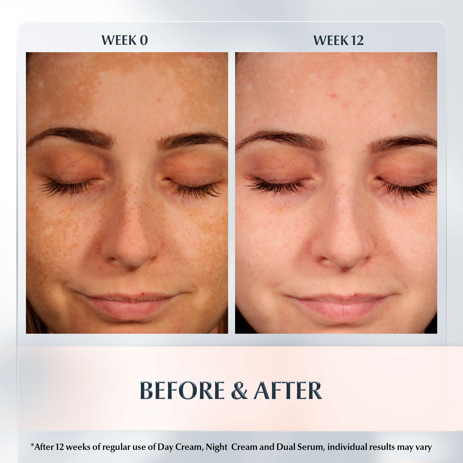 Eucerin Anti-Pigment Night Cream 50Ml